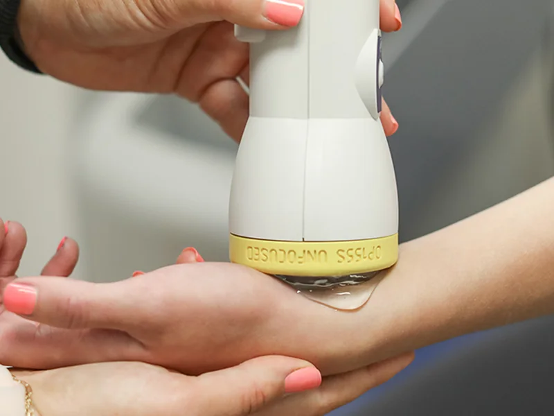 SoftWave Therapy at Wellsprings Health